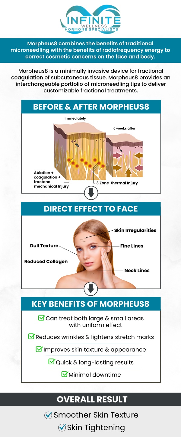 Morpheus8 is a non-invasive treatment that combines microneedling with radiofrequency energy to rejuvenate the skin. It stimulates collagen production, improving skin texture, tone, and elasticity. This treatment can reduce wrinkles, fine lines, and acne scars. At Infinite Wellness Hormone Specialists, Dr. Vanessa Mack (Dean), a board-certified doctor, offers Morpheus8 for personalized, effective skin and body rejuvenation. Our dedicated team is committed to delivering customized care in a supportive and professional environment. For more information, contact us today or schedule an appointment online. We are conveniently located at 7373 N Scottsdale Road, Suite C140, Scottsdale, AZ 85253.